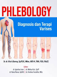 Phlebology: diagnosis dan terapi varises