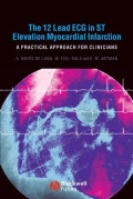 The 12-lead ECG in ST elevation myocardial infarction: a practical approach for clinicians