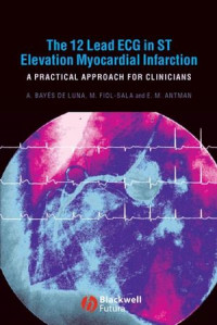 The 12-lead ECG in ST elevation myocardial infarction: a practical approach for clinicians