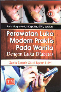 Perawatan luka modern praktis pada wanita dengan luka diabetes