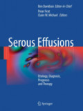 Serous Effusions : Etiology, Diagnosis, Prognosis and Therapy