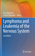 Lymphoma and Leukemia of the Nervous System