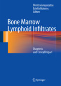 Bone Marrow Lymphoid InfiltratesDiagnosis and Clinical Impact /
