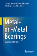 Metal-on-Metal BearingsA Clinical Practicum /