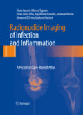 Radionuclide Imaging of Infection and InflammationA Pictorial Case-Based Atlas /